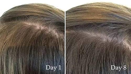 The Ordinary MultiPeptide Serum for Hair Density Review  The Pink Velvet  Blog